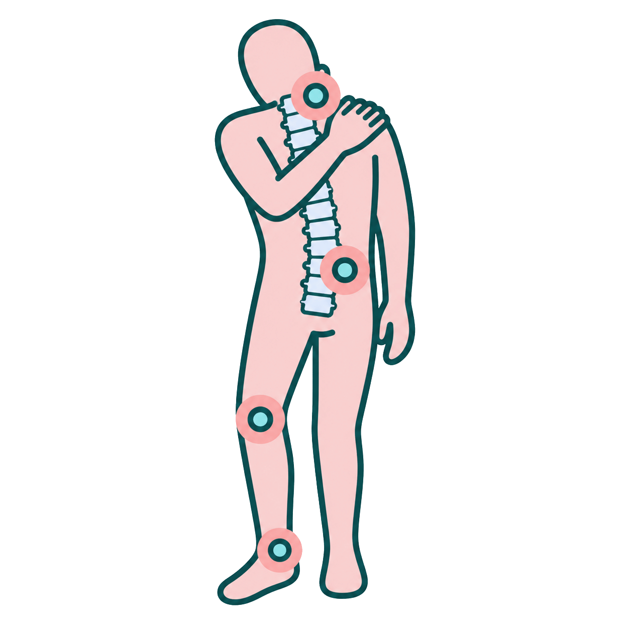 Personal Injury