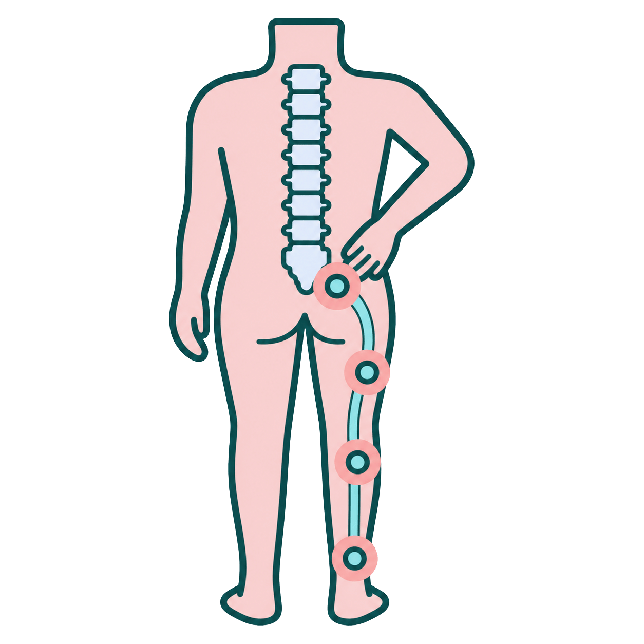 Sciatica