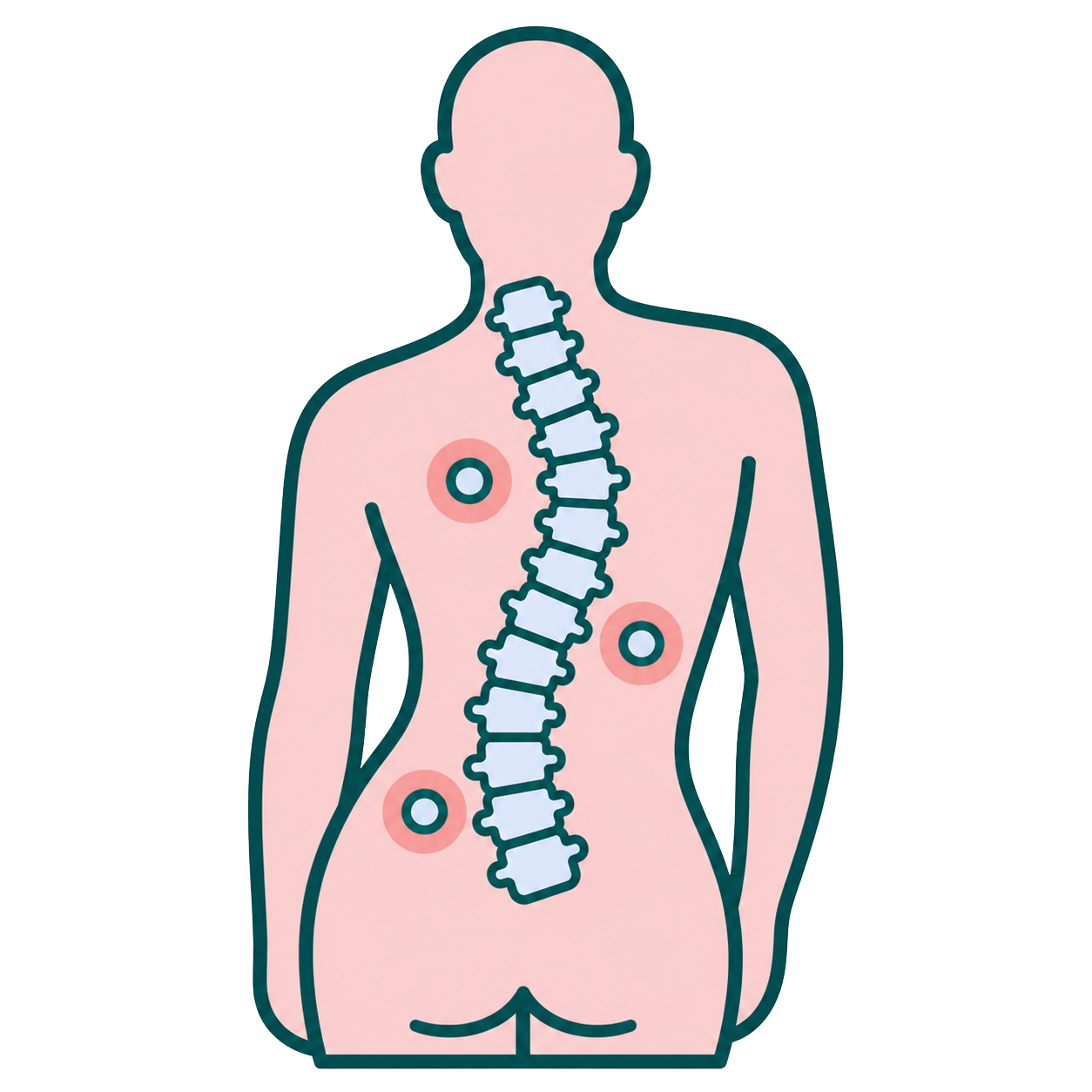 Scoliosis